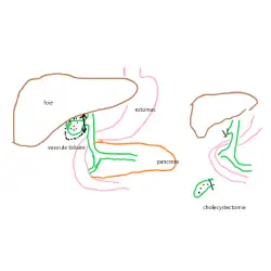 Cholecystectomie