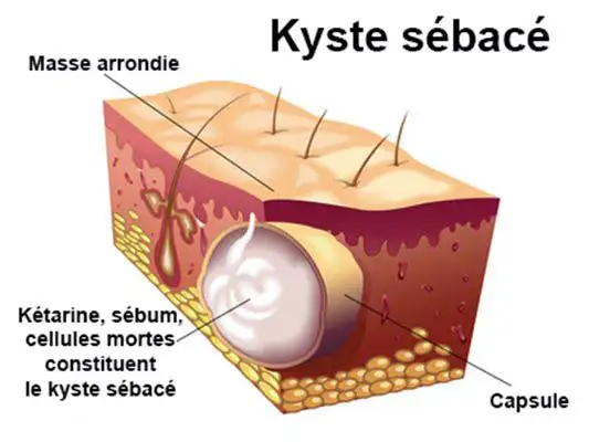 gestes-chirurgicaux-de-superficie-1